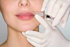 Facial rejuvenation without surgery